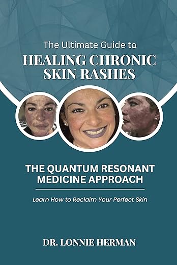 Free: The Ultimate Guide To Healing Chronic Skin Rashes: The Quantum Resonant Medicine Approach - Learn How To Reclaim Your Perfect Skin